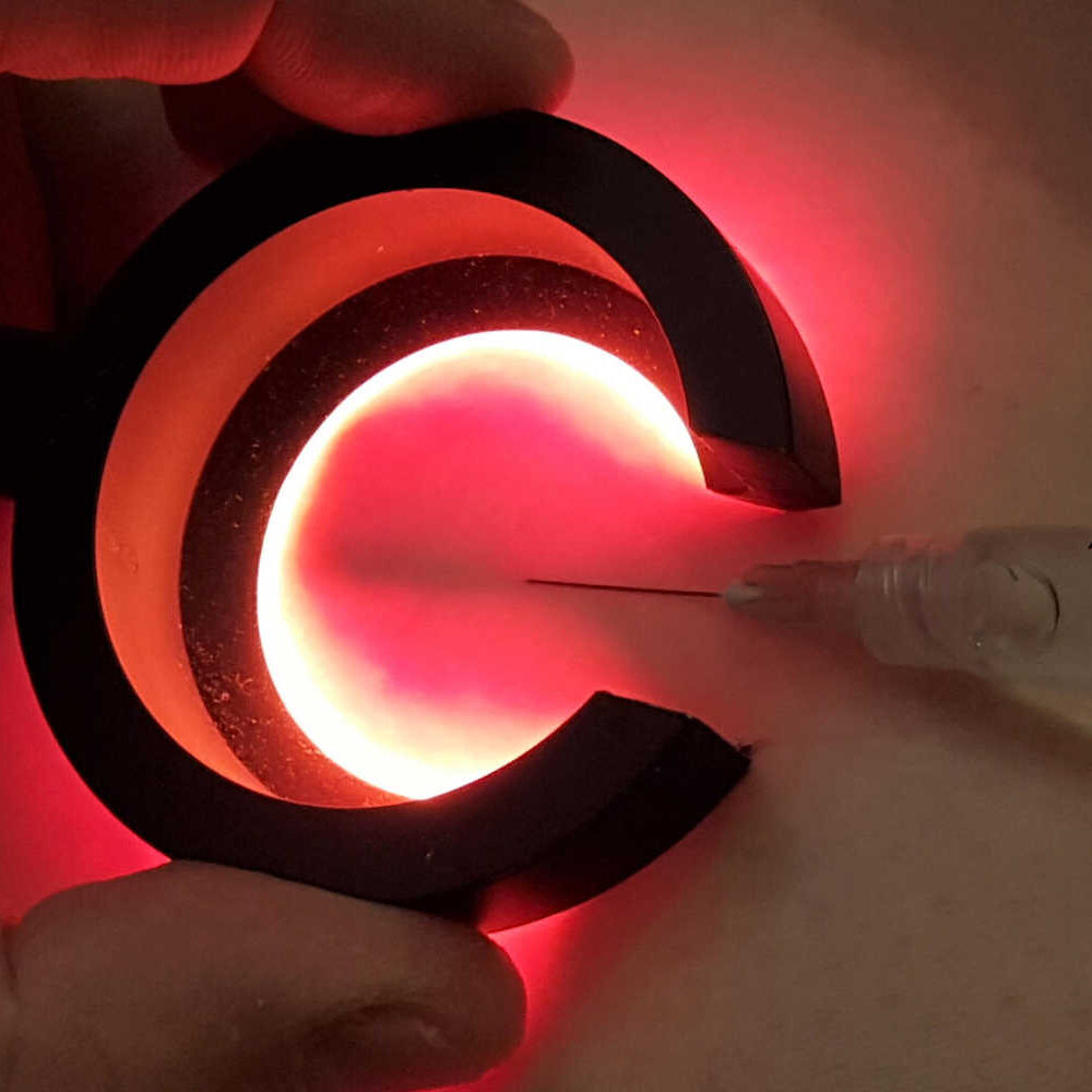 La transilluminazione nel trattamento di varici e capillari