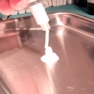 La scleromousse ecoguidata: metodo varixio.