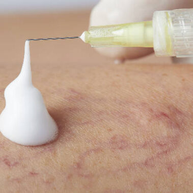 Schiuma prodotta con metodo Varixio.